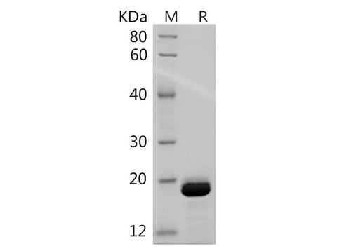 SDS-PAGE analysis of Mouse IL-1 beta/IL1B proteins, 2 μg/lane of Recombinant Mouse IL-1 beta/IL1B proteins was resolved with SDS-PAGE under reducing conditions, showing bands at 16 kDa.