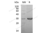 Recombinant Human Dihydropteridine Reductase/QDPR Protein (His Tag) - ABMIUM