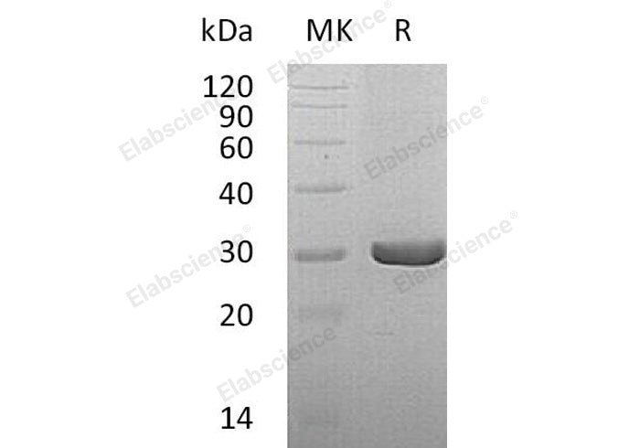Recombinant Human Dihydropteridine Reductase/QDPR Protein (His Tag) - ABMIUM