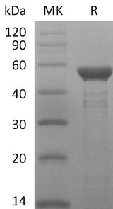 Recombinant MERS-CoV Nucleocapsid Protein - ABMIUM