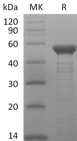 Recombinant MERS-CoV Nucleocapsid Protein - ABMIUM