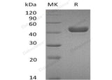 Recombinant Mouse Carbonic Anhydrase 14/Car14 Protein (His Tag) - ABMIUM
