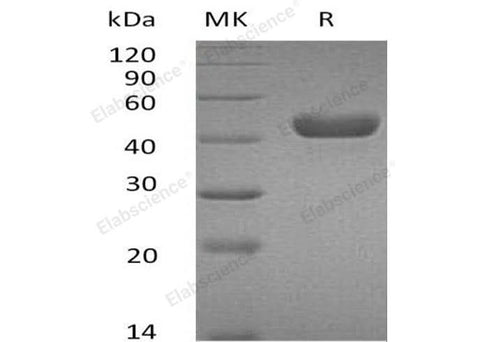 Recombinant Mouse Carbonic Anhydrase 14/Car14 Protein (His Tag) - ABMIUM