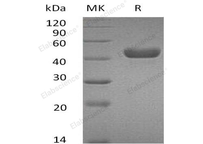 Recombinant Mouse Carbonic Anhydrase 14/Car14 Protein (His Tag) - ABMIUM