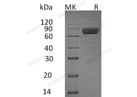 Recombinant Human IL10RB/IL10R2 Protein (Fc Tag) - ABMIUM