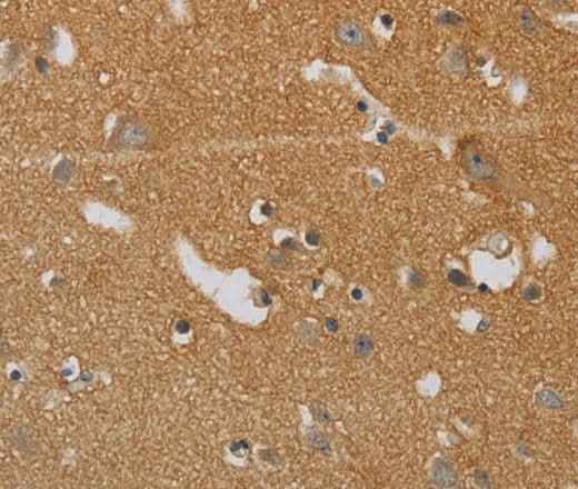 Anti-Human/Mouse KIF4A Antibody