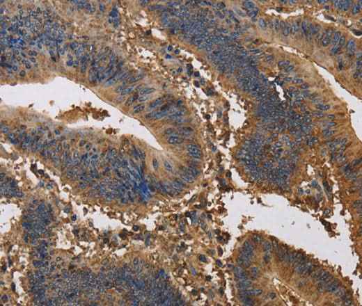 Anti-Human/Mouse/Rat KCNG1 Antibody