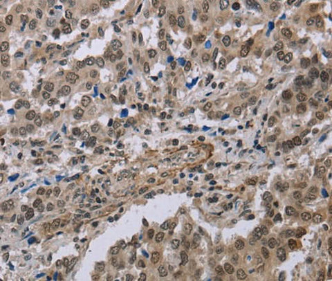 Anti-Human MGLL Antibody - ABMIUM