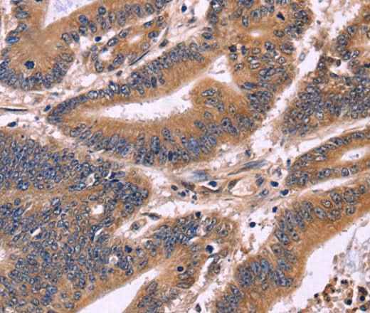 Anti-Human/Mouse S100A13 Antibody