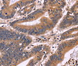 Anti-Human/Mouse S100A13 Antibody - ABMIUM