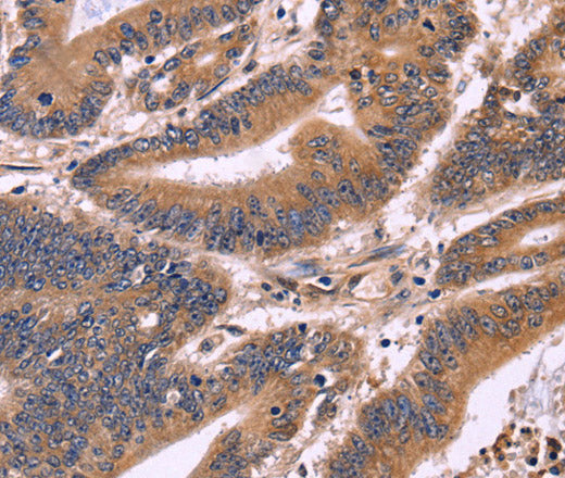 Anti-Human/Mouse S100A13 Antibody - ABMIUM