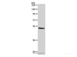 Anti-Human/Mouse/Rat CASP2 Antibody - ABMIUM