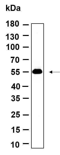 Anti-Human p53 Antibody [B926] - ABMIUM
