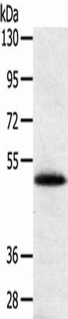 Anti-Human/Mouse SMOC2 Antibody