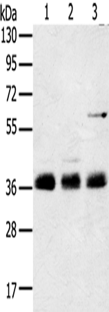 Anti-Human/Mouse/Rat ANKRD1 Antibody - ABMIUM