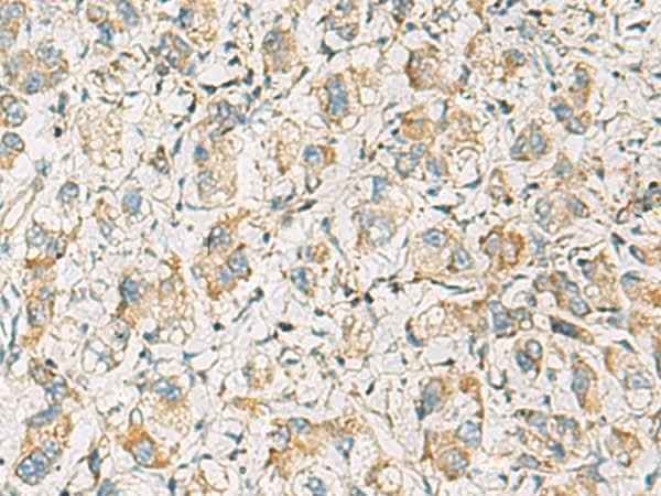 Anti-Human/Mouse/Rat PDE4DIP Antibody