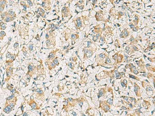 Anti-Human/Mouse/Rat PDE4DIP Antibody