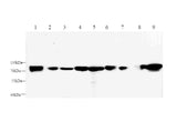 Western blot with Afp Polyclonal antibody at dilution of 1:1000.lane 1:Hep G2 whole cell lysate,lane 2:Mouse placenta,lane 3:Rat placenta,lane 4:Mouse Fetal liver,lane 5:Rat Fetal liver,lane 6: Mouse liver,lane 7:Mouse kidney,lane 8:Rat liver,lane 9:Rat kidney