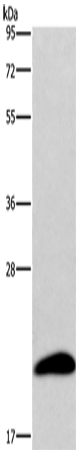 Anti-Human AURKAIP1 Antibody - ABMIUM
