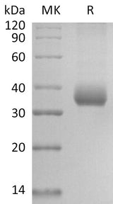 Recombinant SARS-CoV-2 Spike RBD (D364Y)(His Tag) - ABMIUM