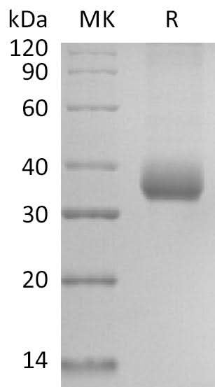 Recombinant SARS-CoV-2 Spike RBD (D364Y)(His Tag) - ABMIUM
