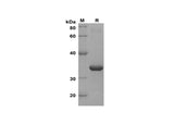 SDS-PAGE analysis of Mouse IL-21 proteins, 2 μg/lane of Recombinant Mouse IL-21 proteins was resolved with SDS-PAGE under reducing conditions, showing bands at 34 kDa.