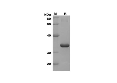 SDS-PAGE analysis of Mouse IL-21 proteins, 2 μg/lane of Recombinant Mouse IL-21 proteins was resolved with SDS-PAGE under reducing conditions, showing bands at 34 kDa.
