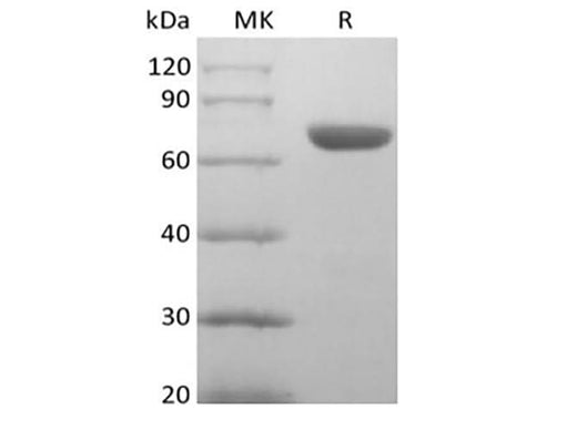 Recombinant Human EphA8 (C-6His) - ABMIUM