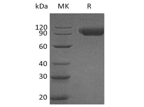 Recombinant Human SIGLEC9/CD329 Protein (Fc Tag) - ABMIUM