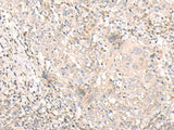 Anti-Human IL24 Antibody - ABMIUM