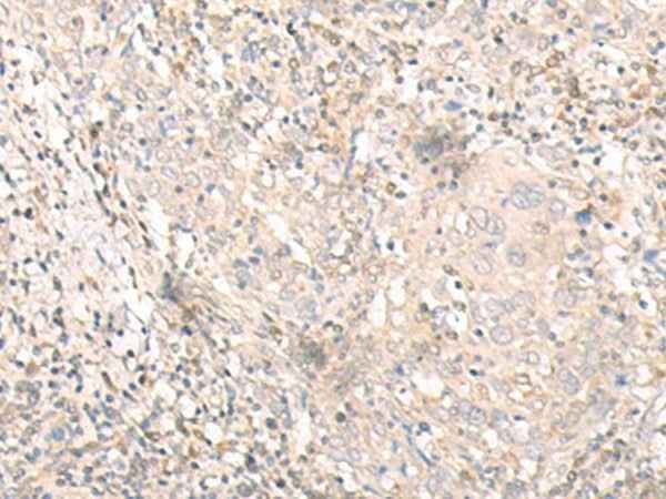 Anti-Human IL24 Antibody