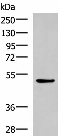 Western blot analysis of LOVO cell lysate using BLNK Polyclonal Antibody at dilution of 1:600