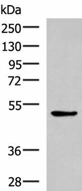 Western blot analysis of LOVO cell lysate using BLNK Polyclonal Antibody at dilution of 1:600