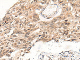 Anti-Human/Mouse KNOP1 Antibody - ABMIUM