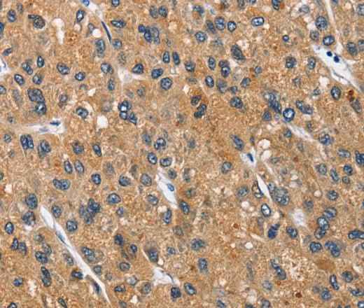 Anti-Human CEACAM3 Antibody