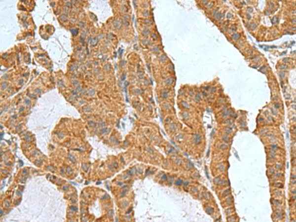 Anti-Human/Mouse ITGB1BP1 Antibody