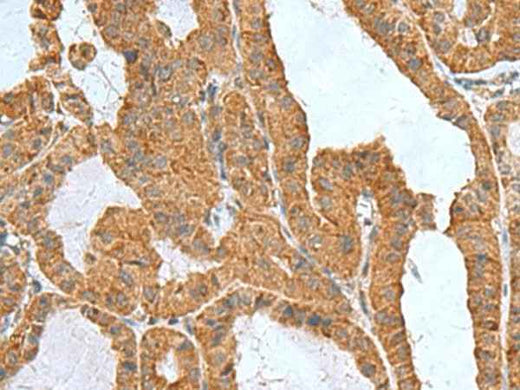 Anti-Human/Mouse ITGB1BP1 Antibody