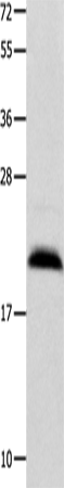 Anti-Human/Mouse/Rat FGF12 Antibody - ABMIUM