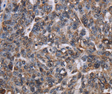 Anti-Human LDOC1 Antibody - ABMIUM