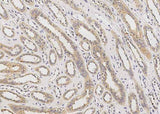 Anti-Human AGER Antibody [A1066] - ABMIUM