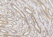 Anti-Human AGER Antibody [A1066] - ABMIUM