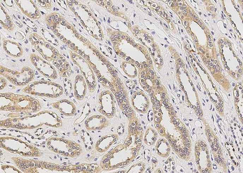 Anti-Human AGER Antibody [A1066] - ABMIUM