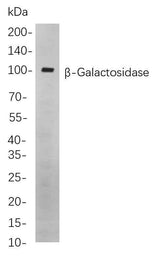 Anti-Human/Mouse/Rat β-Galactosidase Antibody [B852]