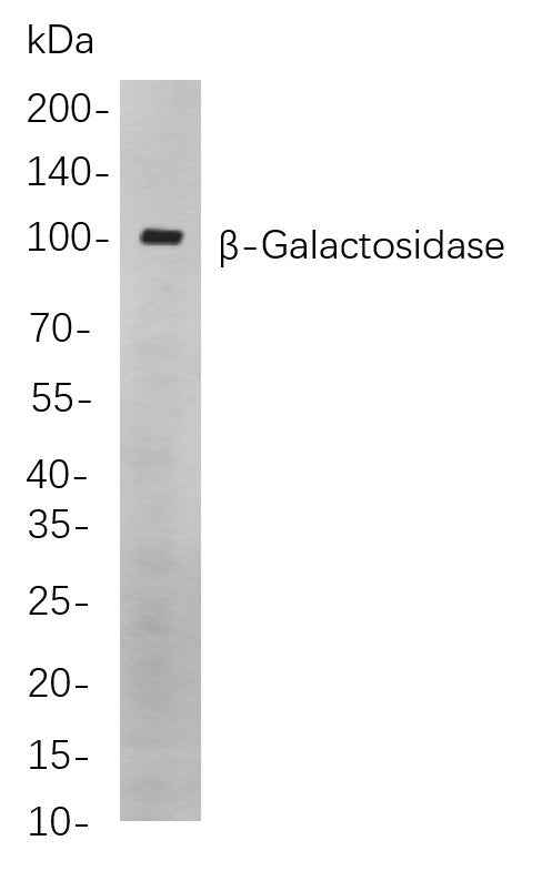 Anti-Human/Mouse/Rat β-Galactosidase Antibody [B852] - ABMIUM