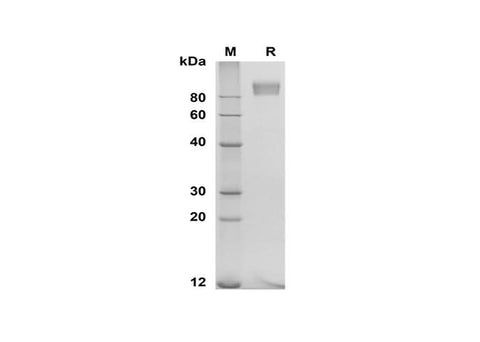 SDS-PAGE analysis of Human E-Selectin proteins, 2 μg/lane of Recombinant Human E-Selectin proteins was resolved with SDS-PAGE under reducing conditions, showing bands at 80-100 kDa.