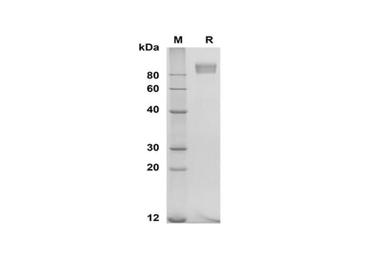 SDS-PAGE analysis of Human E-Selectin proteins, 2 μg/lane of Recombinant Human E-Selectin proteins was resolved with SDS-PAGE under reducing conditions, showing bands at 80-100 kDa.
