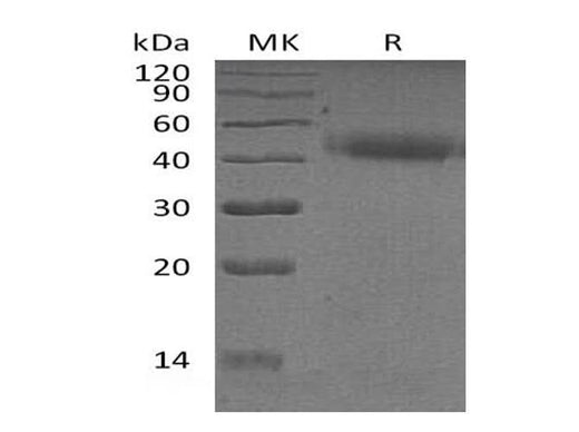 Recombinant Human PSG2 Protein (His Tag) - ABMIUM