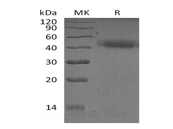 Recombinant Human PSG2 Protein (His Tag) - ABMIUM