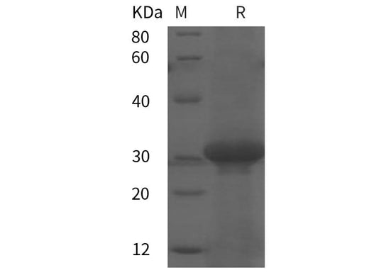 SDS-PAGE analysis of Human KL proteins, 2 μg/lane of Recombinant Human KL proteins was resolved with SDS-PAGE under reducing conditions, showing bands at 31 kDa.