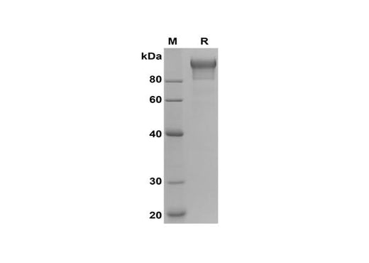 SDS-PAGE analysis of Human Semaphorin-4D/CD100 proteins, 2 μg/lane of Recombinant Human Semaphorin-4D/CD100 proteins was resolved with SDS-PAGE under reducing conditions, showing bands at 90-110 kDa.